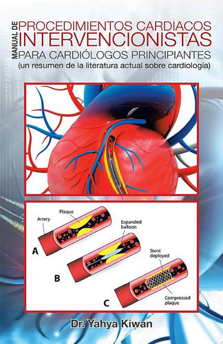 Manual De Procedimientos Cardiacos Intervencionistas Para Cardiólogos Principiantes