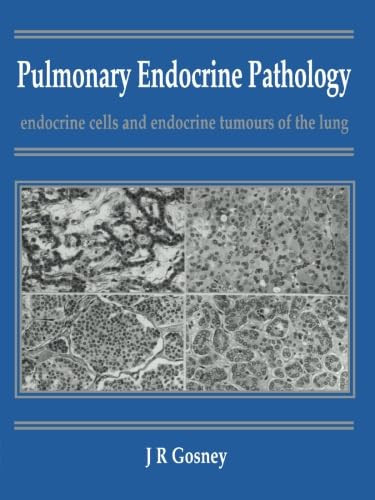 Pulmonary Endocrine Pathology: Endocrine Cells and Endocrine Tumours of the Lung
