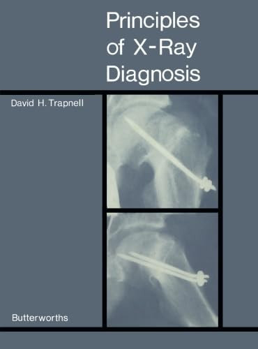Principles of X-Ray Diagnosis