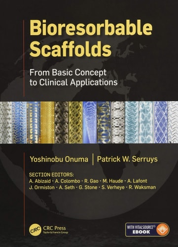 Bioresorbable Scaffolds From Basic Concept to Clinical Applications