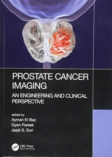 Prostate Cancer Imaging An Engineering and Clinical Perspective