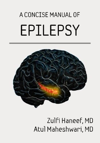 A Concise Manual of Epilepsy