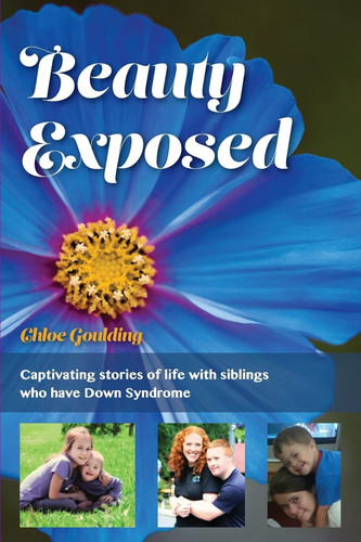 Beauty Exposed Captivating Stories of Life with Siblings who Have Down Syndrome