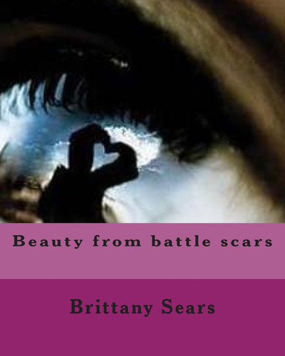 Beauty from Battle Scars