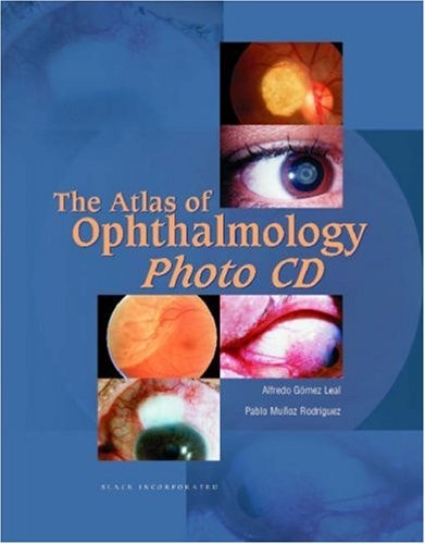 Atlas of Ophthalmology