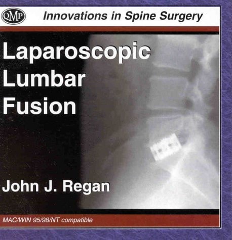 Techniques in Endoscopic Spine Surgery **CD-ROM**