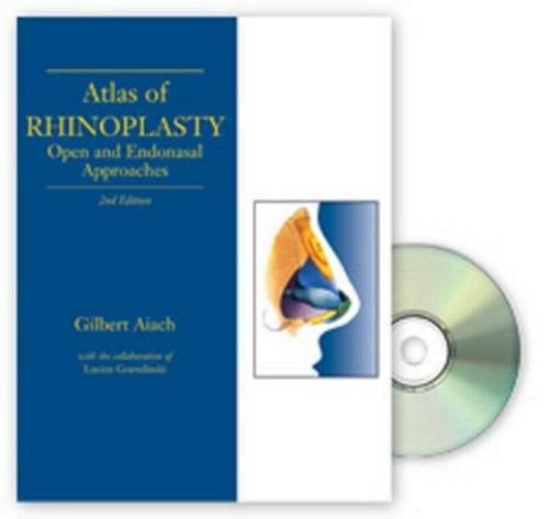 Atlas of Rhinoplasty Open and Endonasal Approaches