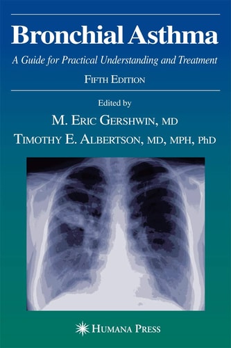 Bronchial Asthma A Guide for Practical Understanding and Treatment