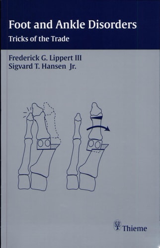 Foot and Ankle Disorders Tricks of the Trade