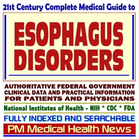 21st Century Complete Medical Guide to Esophagus Disorders, Authoritative Government Documents, Clinical References, and Practical Information for Patients and Physicians