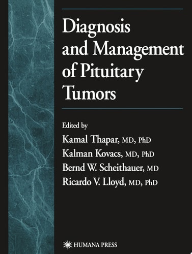 Diagnosis and Management of Pituitary Tumors