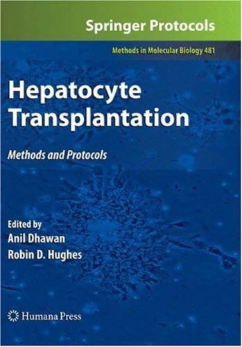 Hepatocyte transplantation: methods and protocols