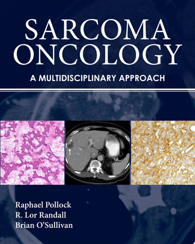 Sarcoma Oncology