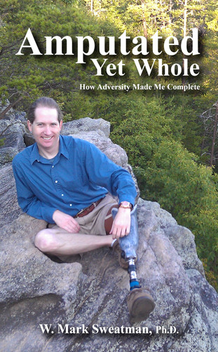 Amputated Yet Whole How Adversity Made Me Complete