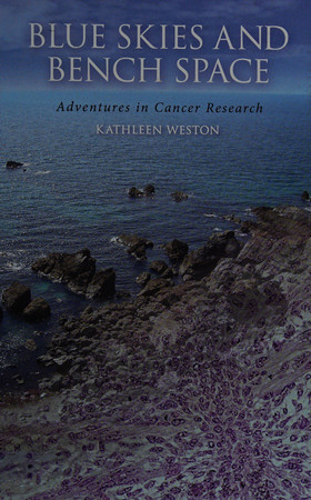 Blue skies and bench space: adventures in cancer research