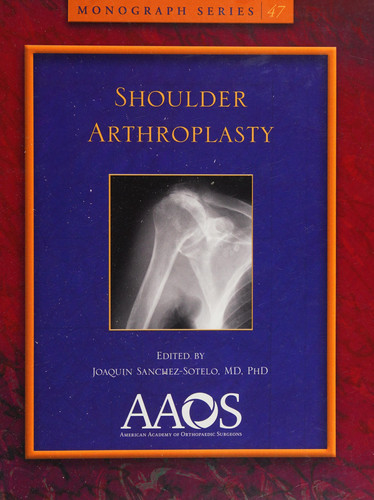 Shoulder arthroplasty