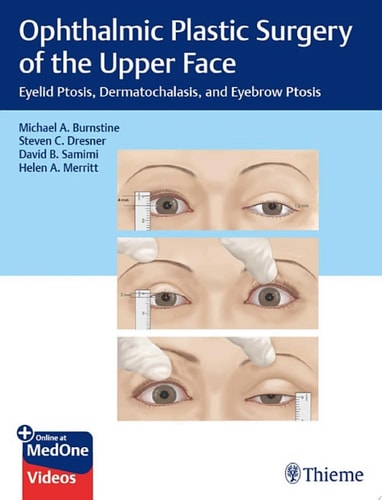Ophthalmic Plastic Surgery of the Upper Face Eyelid Ptosis, Dermatochalasis, and Eyebrow Ptosis