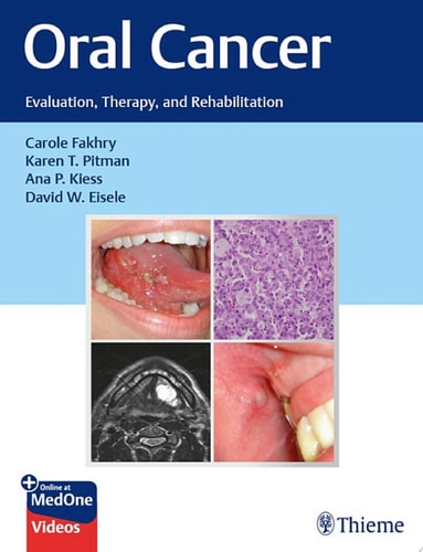 Oral Cancer Evaluation, Therapy, and Rehabilitation