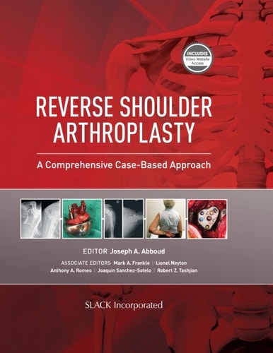 Reverse Shoulder Arthroplasty A Comprehensive Case-based Approach