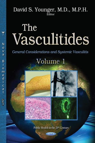 The Vasculitidies General Considerations and Systemic Vasculitis