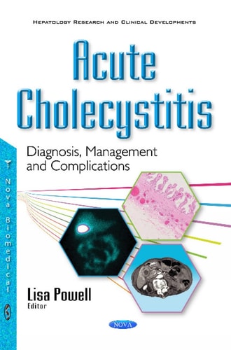 Acute Cholecystitis Diagnosis, Management and Complications