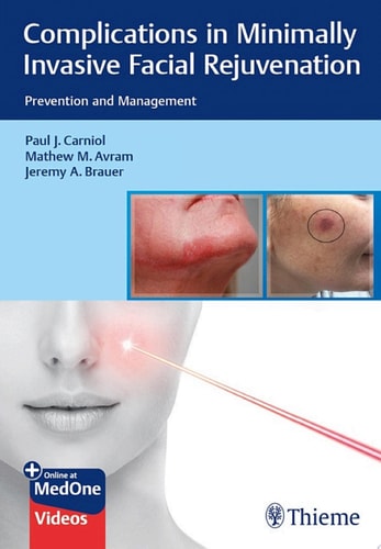 Complications in Minimally Invasive Facial Rejuvenation Prevention and Management
