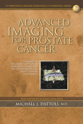 Advanced Imaging for Prostate Cancer A Primer on 3D Color-Flow Power Doppler Ultrasound, Multiparametric MRI and CT Fusion Techniques