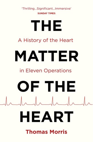 The Matter of the Heart A History of the Heart in Eleven Operations