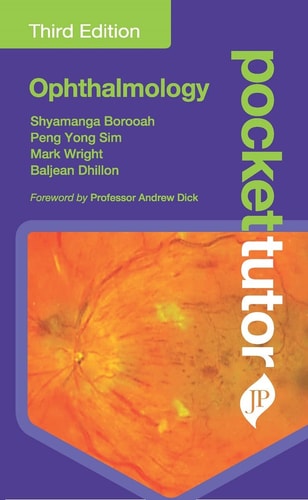 Pocket Tutor Ophthalmology Third Edition