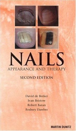 Nails: Pocketbook Appearance and Therapy