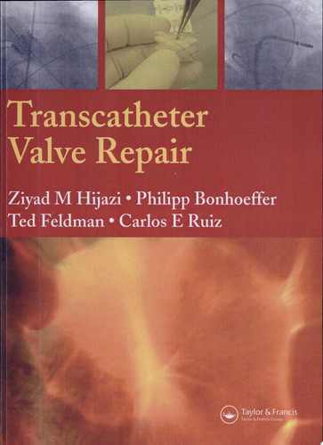 Transcatheter Valve Repair