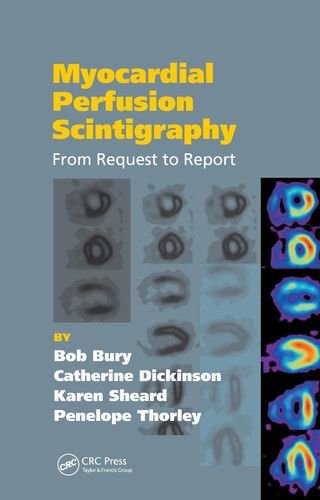Myocardial Perfusion Scintigraphy From Request to Report