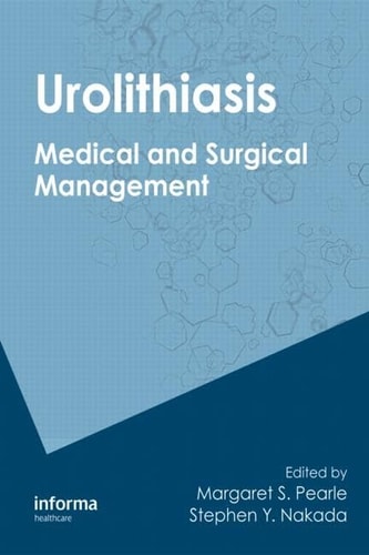 Urolithiasis Medical and Surgical Management of Stone Disease