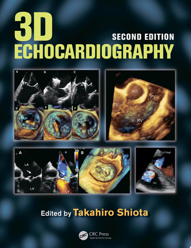 3D Echocardiography, Second Edition