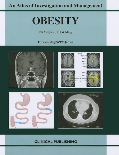Obesity An Atlas of Investigation and Management