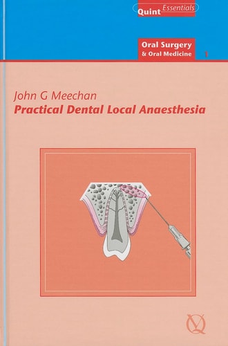 Practical Dental Local Anaesthesia