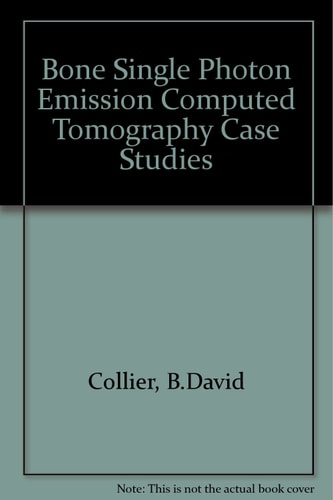 Bone SPECT Case Studies