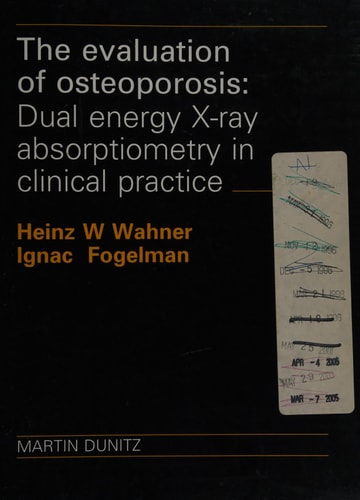 Evaluation of Osteoporosis