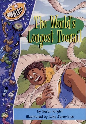 The World's Longest Toenail