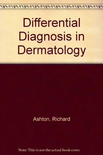 Differential Diagnosis in Dermatology