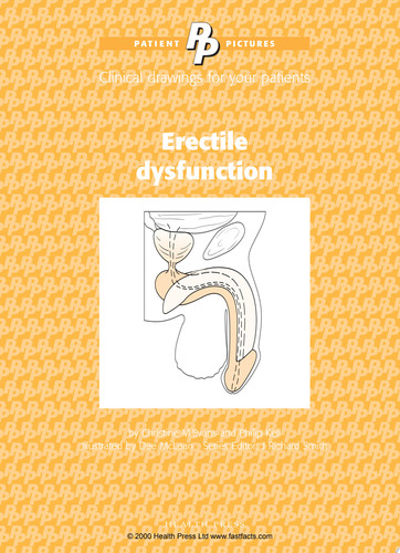 Patient Pictures: Erectile Dysfunction