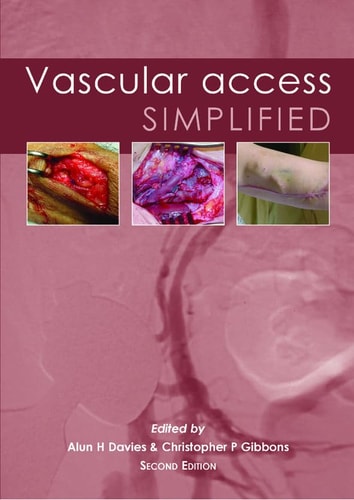 Vascular Access Simplified