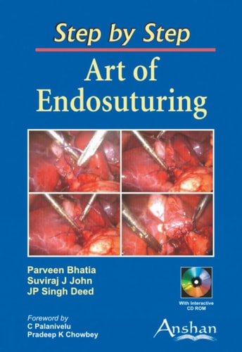 Art of Endosuturing