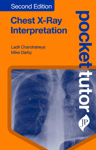 Pocket Tutor Chest X-Ray Interpretation Second Edition