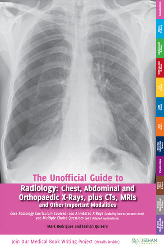 The Unofficial Guide to Radiology Chest, Abdominal and Orthopaedic X-rays, Plus CTs, MRIs and Other Important Modalities