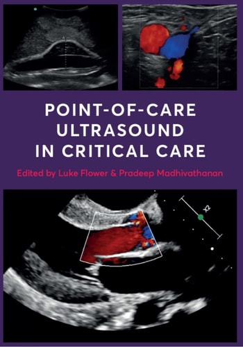 Point-Of-Care Ultrasound in Critical Care