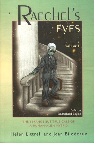 Raechel's Eyes A Strange Case of an Apparent Hybrid- Human/Alien