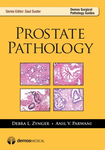 Prostate Pathology