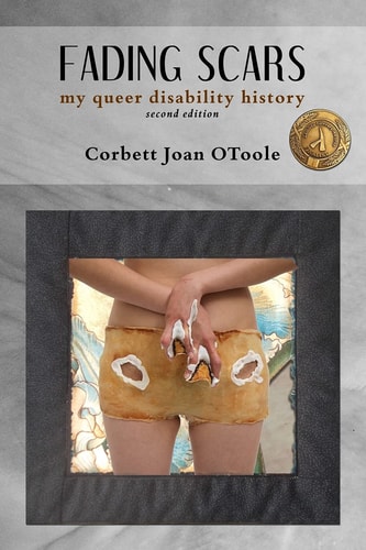 Fading Scars My Queer Disability History, 2nd Edition