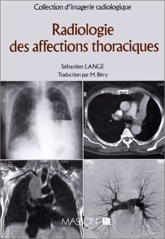 Radiologie des affections thoraciques